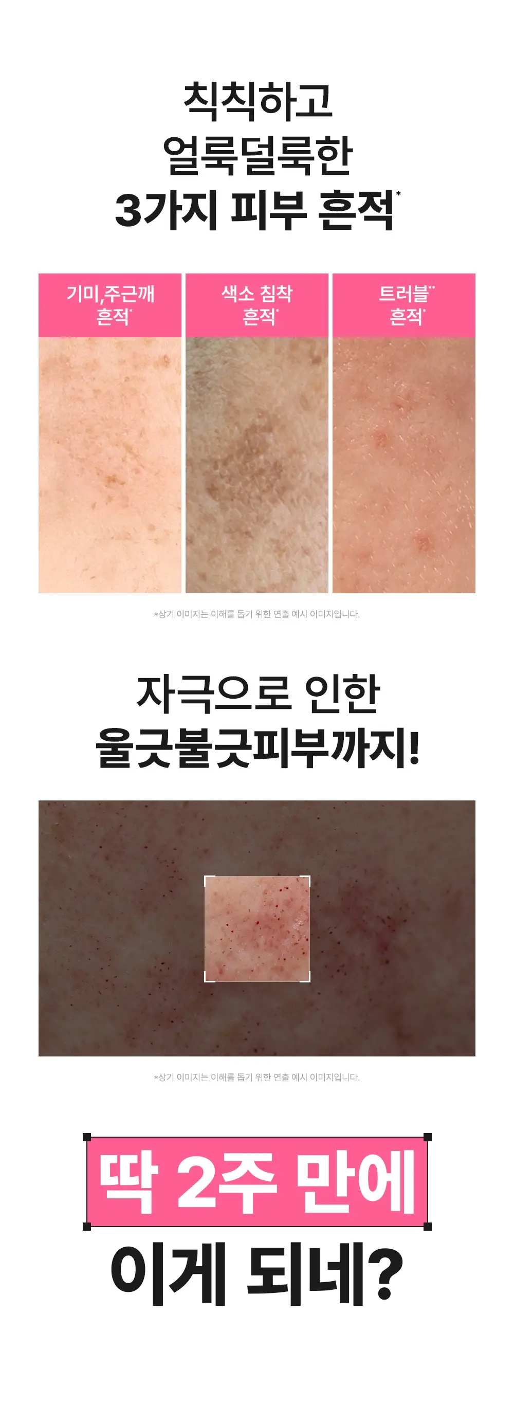 [트러블흔적/광채] 비긴스 바이 정샘물 나이아신아마이드10 흔적크림 50ml 상세페이지 3